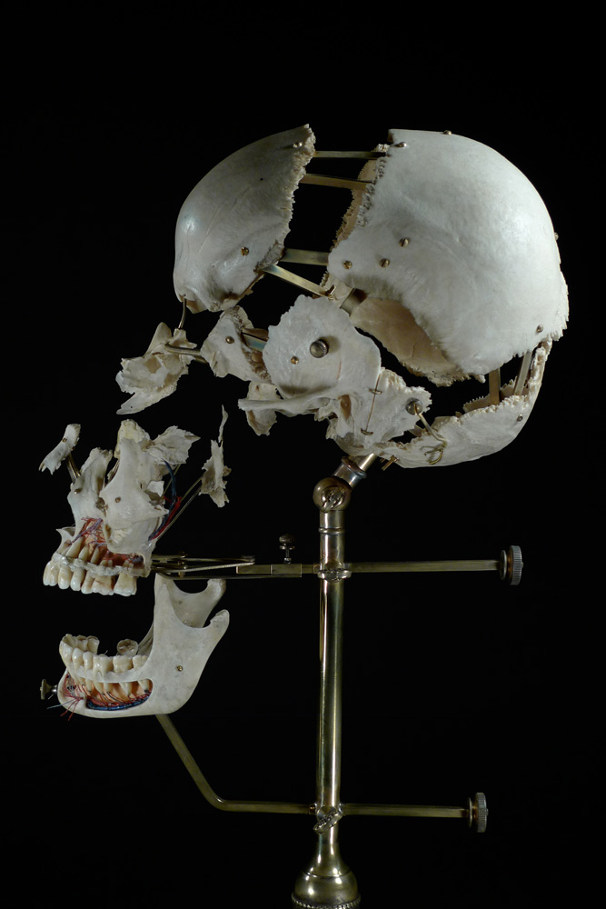 Ryan Matthew Cohn; Exploded/Beauchene Human Skull, 2012–14: Bone, antique brass; Photo: Sergio Royzen
